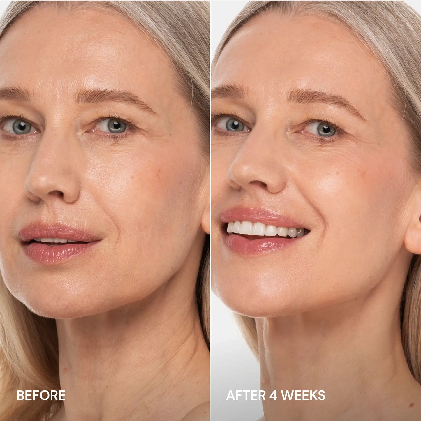 Pro-Retinol Neck Lifting Cream | Advanced  Restoration