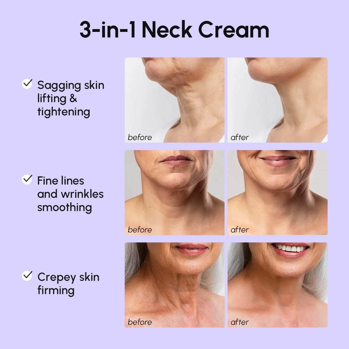 Pro-Retinol Neck Lifting Cream | Advanced  Restoration