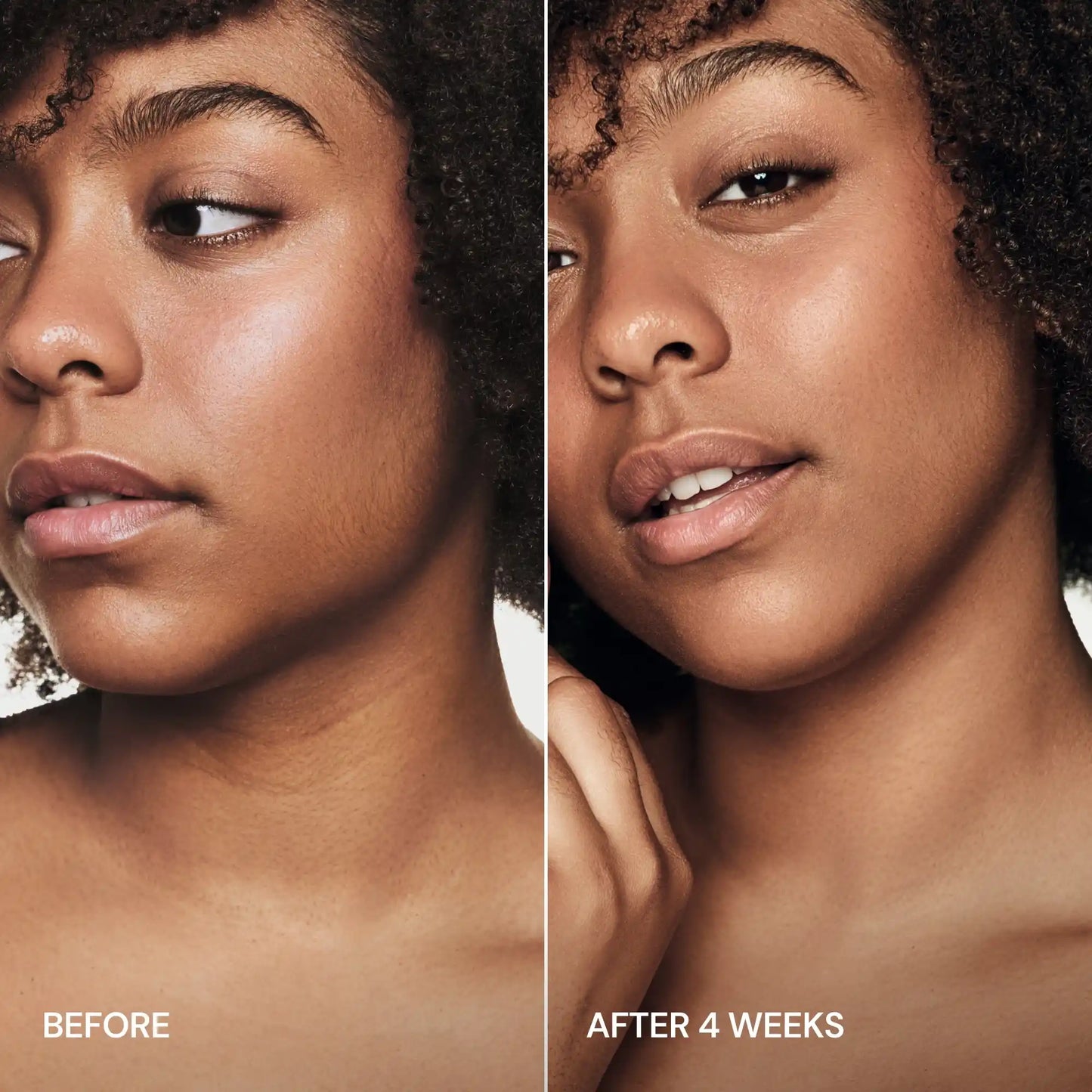 Pro-Retinol Neck Lifting Cream | Advanced  Restoration