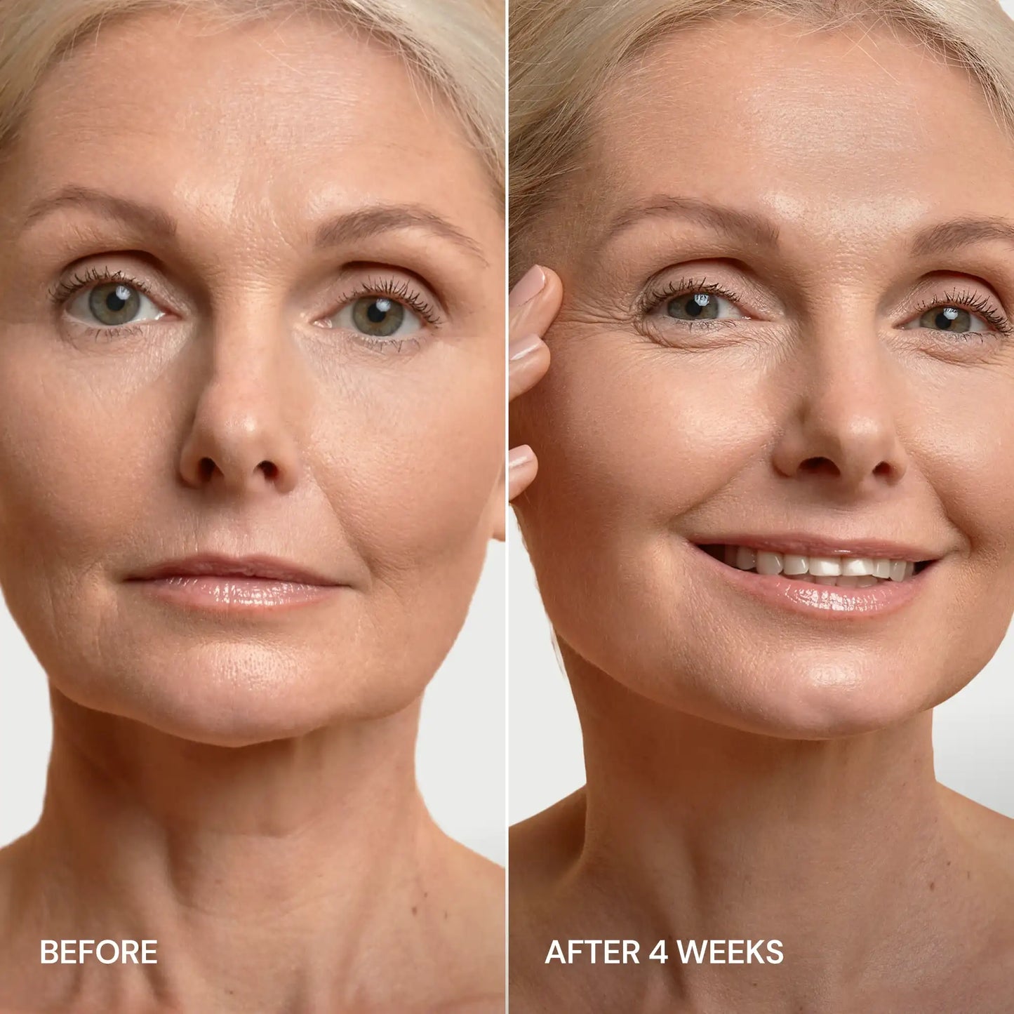 Pro-Retinol Neck Lifting Cream | Advanced  Restoration